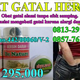 Illustration for article titled Cara mengatasi gatal gatal di selangkangan paha